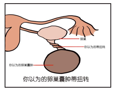 腹痛运动后右下腹痛_运动后腹痛_腹痛运动后缓解的病机