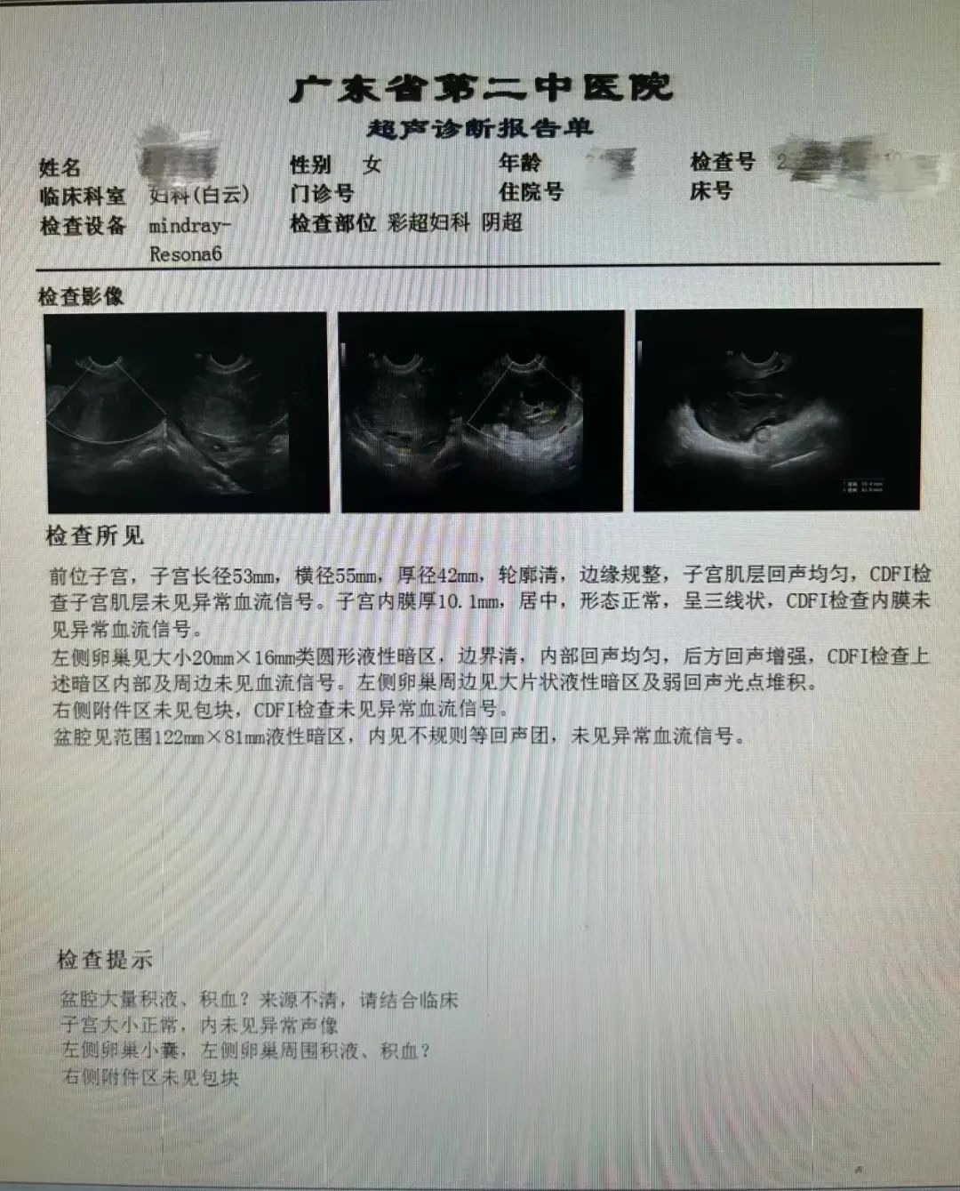 腹痛运动后就减轻_运动后腹痛_腹痛运动后右下腹痛