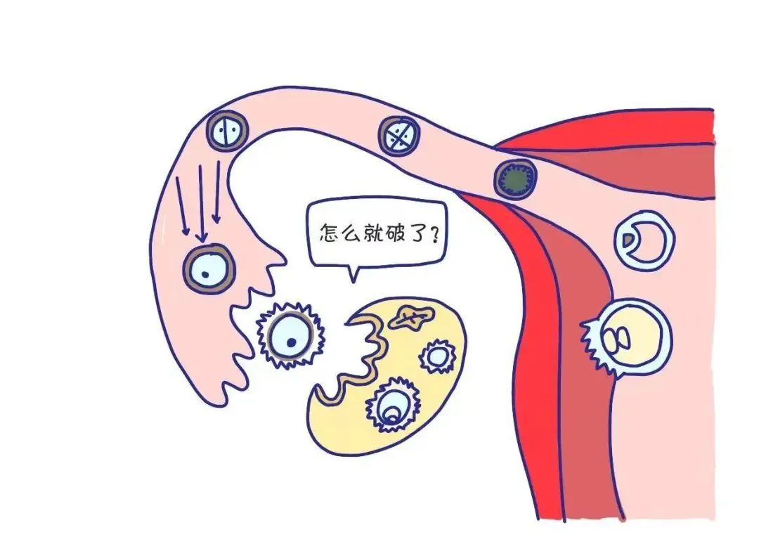 运动后腹痛_腹痛运动后就减轻_腹痛运动后右下腹痛